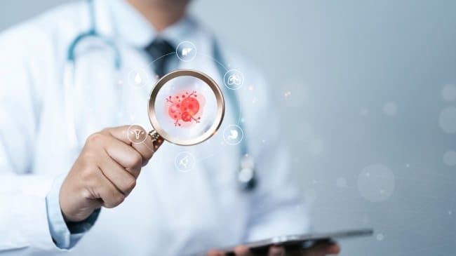 Adenokarsinoma: Gejala, Penyebab, dan Pengobatannya - Alodokter