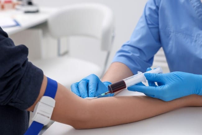 Eosinofil Tinggi, Kemungkinan Penyebab dan Penanganannya - Alodokter