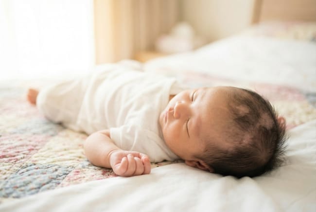 Rambut Bayi Tumbuh Tidak Rata, Ketahui Penyebab dan Cara Mengatasinya - Alodokter
