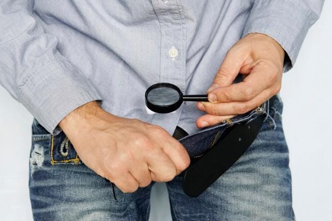 Apakah Kutil Kelamin Bisa Sembuh? Kenali Fakta dan Cara Penanganannya - Alodokter