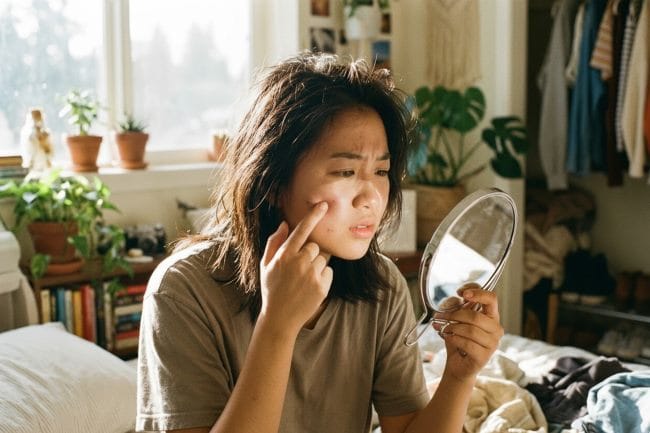 Apakah Jerawat Boleh Dipencet? Ketahui Jawabannya di Sini - Alodokter