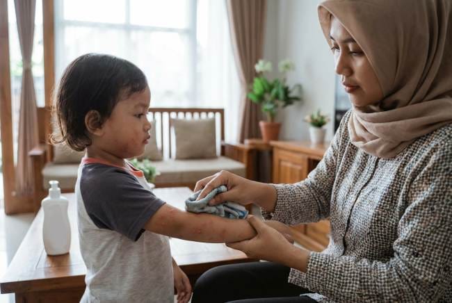 6 Cara Mengatasi Biduran pada Anak dengan Tepat - Alodokter