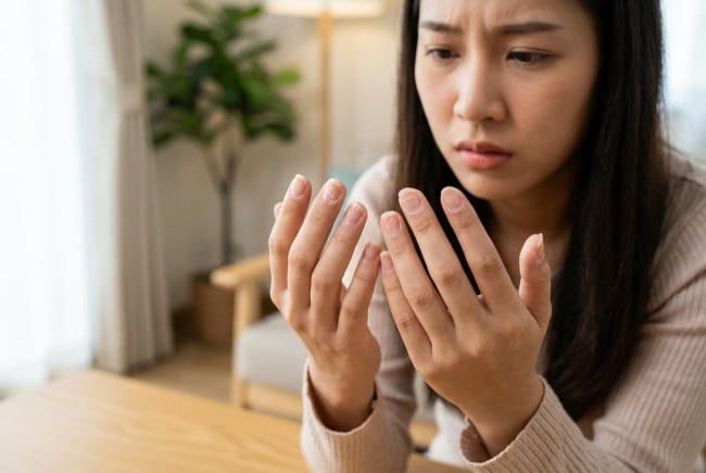 Kuku Rapuh, Ketahui Penyebab dan Tips Mengatasinya - Alodokter