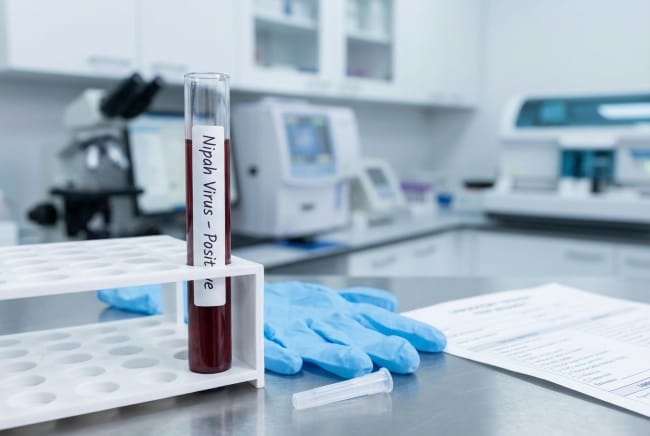 Virus Nipah