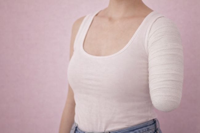 Tangan Putus, Ini Penyebab Paling Umum dan Cara Perawatannya - Alodokter