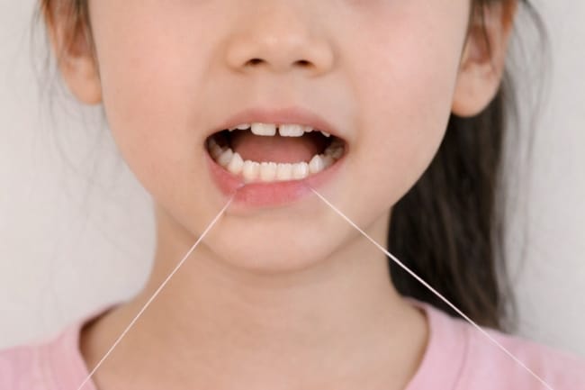 Cara agar Gigi Goyang Lepas secara Alami, Apakah Bisa? Ini Jawabannya - Alodokter