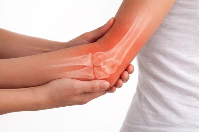 Sendi Engsel, Ketahui Fungsi dan Gangguan yang Dapat Terjadi - Alodokter