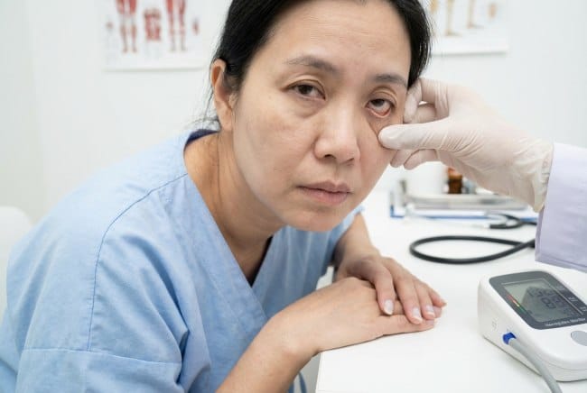 9 Penyakit Akibat Kekurangan Zat Besi - Alodokter