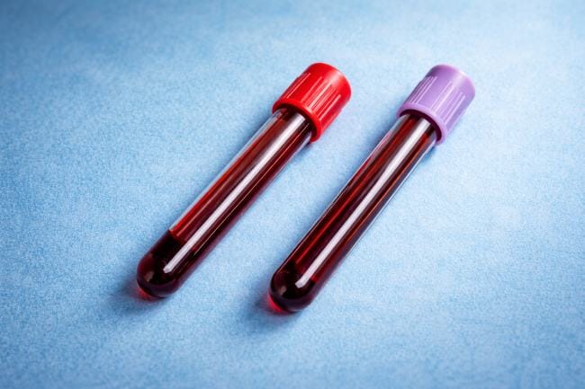 Cara Baca Hasil Lab Darah dengan Benar - Alodokter