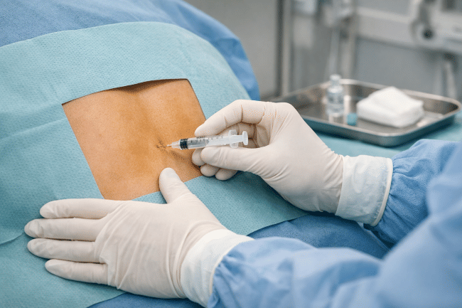 Intratekal, Inilah Kegunaan, Prosedur, dan Risikonya - Alodokter