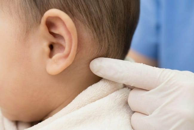 Benjolan di Belakang Telinga Bayi, Ketahui Penyebab, Cara Mengatasi, dan Kapan Harus Waspada - Alodokter