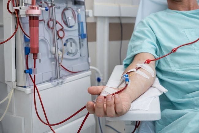 Bisakah Berhenti Cuci Darah? Ini Jawabannya - Alodokter