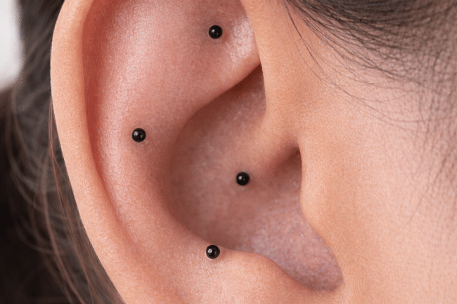 Ear Seeds, Terapi Akupuntur pada Telinga - Alodokter