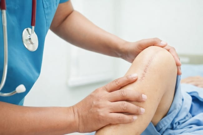 Operasi MCL, Ini yang Harus Anda Ketahui - Alodokter