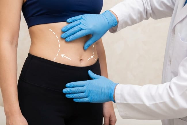 Body Sculpting, Solusi Bentuk Tubuh Ideal Tanpa Operasi - Alodokter