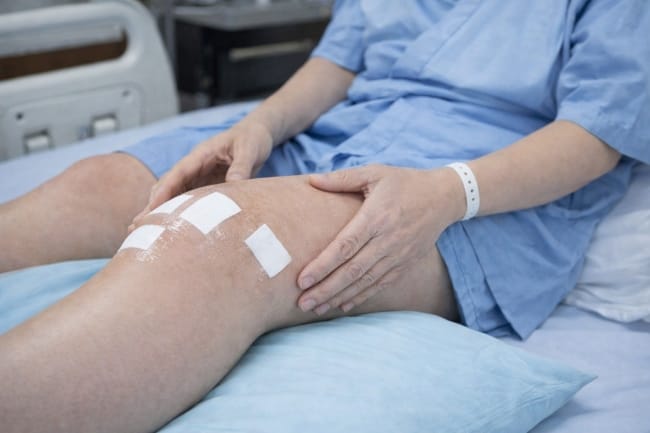 Rekonstruksi PCL, Ini yang Harus Anda Ketahui - Alodokter