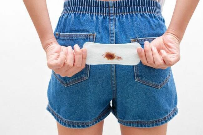 Flek Coklat pada Remaja, Kenali Penyebab dan Cara Mengatasinya - Alodokter