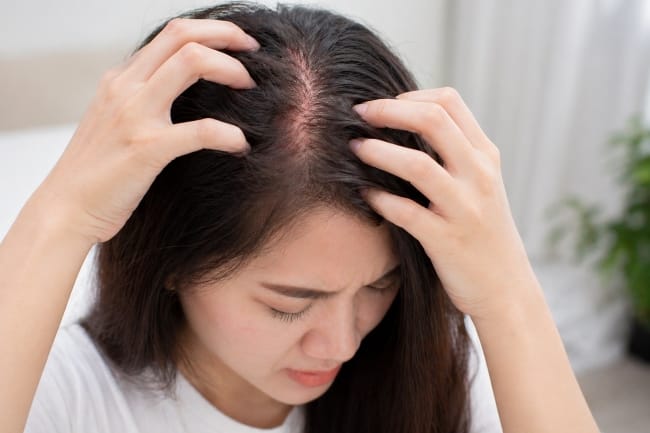 Kulit Kepala Sensitif, Ini Penyebab, Gejala, dan Perawatannya - Alodokter