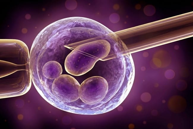 Rumah Sakit Terbaik untuk Inseminasi Buatan - Alodokter