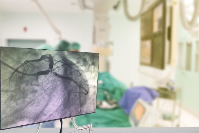 Rumah Sakit Terbaik untuk Cath Lab - Alodokter