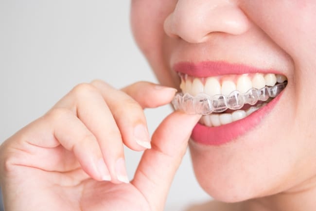 Rumah Sakit Terbaik untuk Invisalign - Alodokter