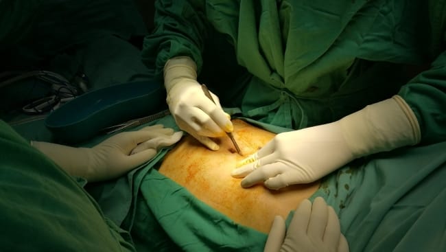 Rumah Sakit Terbaik untuk Laparotomi - Alodokter