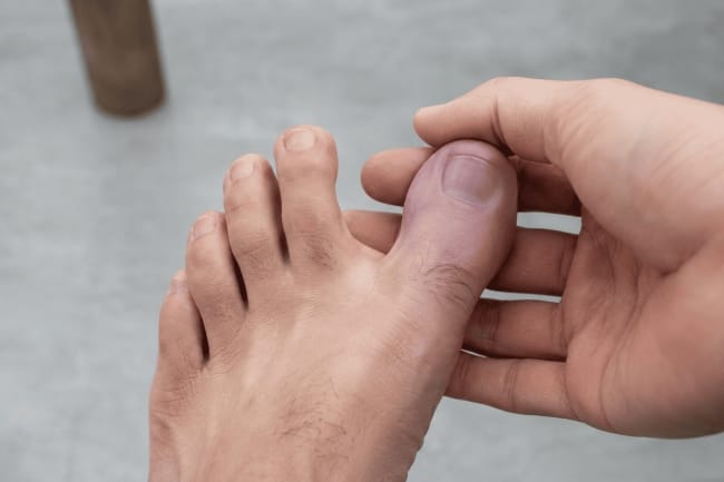 Jempol Kaki Kebas, Ini Penyebab dan Cara Mengatasinya - Alodokter