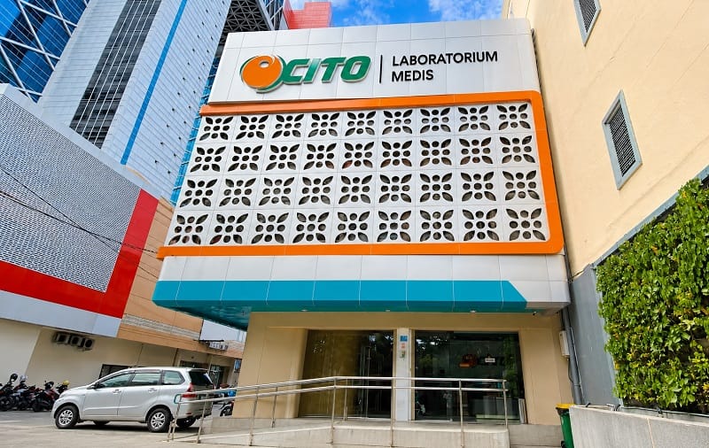 Laboratorium Terbaik di Surabaya - Alodokter