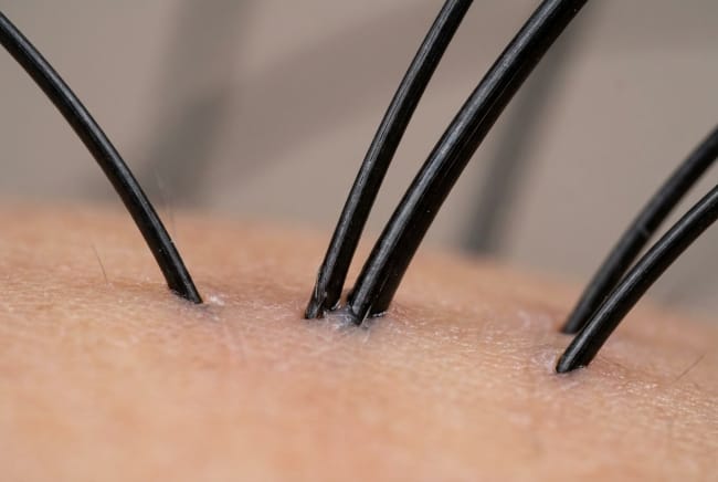 Kenali Akar Rambut dan Cara Menjaganya Tetap Sehat - Alodokter