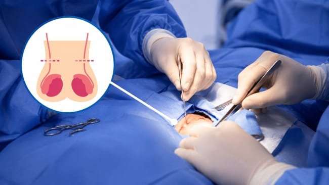 Rumah Sakit Terbaik untuk Vasektomi di Jakarta - Alodokter