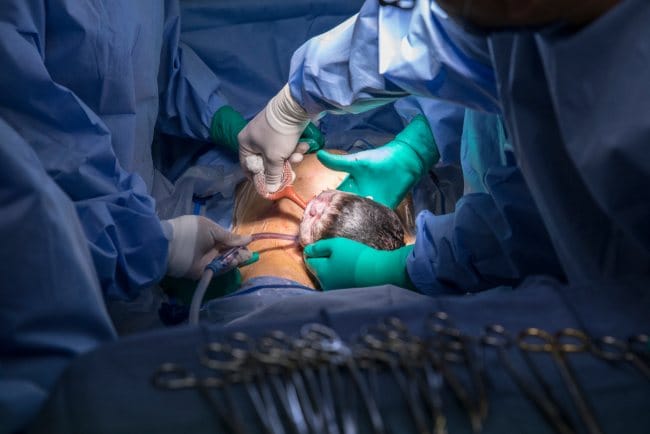 Rumah Sakit Terbaik untuk Operasi Caesar di Tangerang - Alodokter