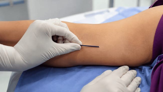Rumah Sakit Terbaik untuk Implan KB di Tangerang - Alodokter
