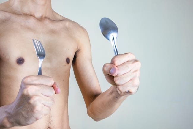 Malnutrisi, Kenali Penyebab, Gejala, dan Cara Mengatasinya - Alodokter